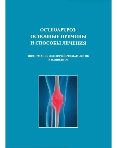 Остеоартроз