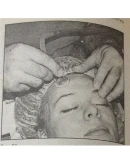 Реферат на тему Баночный массаж Вакуумный массаж Реферат на тему Баночный массаж Вакуумный массаж