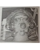 Реферат на тему Баночный массаж Вакуумный массаж Реферат на тему Баночный массаж Вакуумный массаж