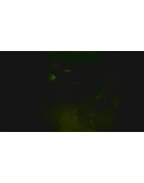 Amigdala STEAM KEY REGION FREE GLOBAL