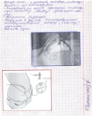 Пример заполнения дневника по практике сестринское дело