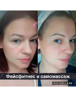 Фейсфитнес и самомассаж (Наталья Травникова)