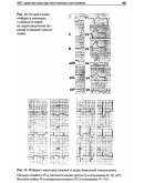 Джанашия П. Х. Неотложная кардиология.