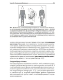 Неврология для врачей общей практики. Л. Гинсберг