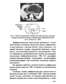 Н.Б Губергриц. Практическая панкреатология