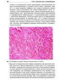 Пауков В.С. - Патологическая анатомия. Том 1