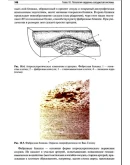 Пауков В.С. - Патологическая анатомия. Том 1