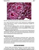 Пауков В.С. - Патологическая анатомия. Том 2