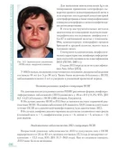 Синдром Шегрена - Сафонова Т. Н. Синдром Шегрена - Сафонова Т. Н.