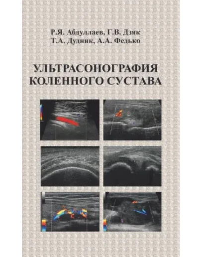 Ультрасонография коленного сустава - Абдуллаев Р.Я.