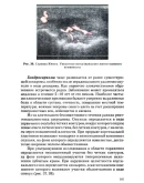 Ультрасонография коленного сустава - Абдуллаев Р.Я.