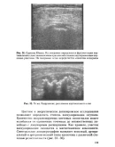 Ультрасонография коленного сустава - Абдуллаев Р.Я.