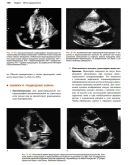 Ультразвуковое исследование в неотложной медицине О. Дж
