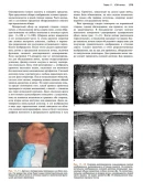 Ультразвуковое исследование в неотложной медицине О. Дж