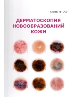 Дерматоскопия новообразований кожи. А.Д. Гетьман