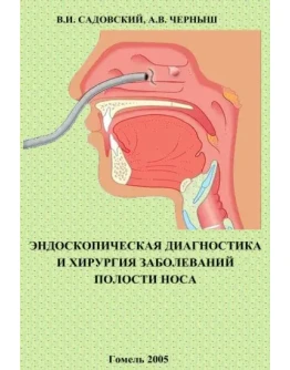 Диагностика и хирургия заболеваний полости носа