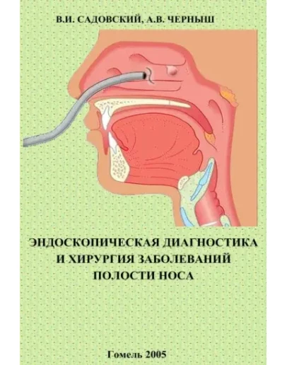 Диагностика и хирургия заболеваний полости носа Диагностика и хирургия заболеваний полости носа