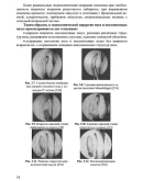 Диагностика и хирургия заболеваний полости носа Диагностика и хирургия заболеваний полости носа