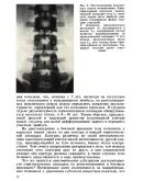 Рентгенодиагностика смещений поясничных позвонков 1979