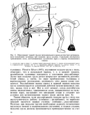 Рентгенодиагностика смещений поясничных позвонков 1979