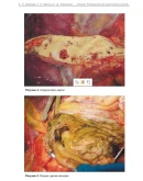 Верткин А. Л. Анемия. Руководство для практических врач