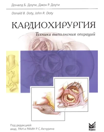 Кардиохирургия. Техника выполнения операций - 2014