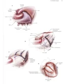 Кардиохирургия. Техника выполнения операций - 2014
