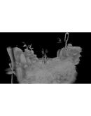 Weakless Xbox One &amp Xbox Series XS активация