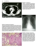 Атлас патологии Роббинса и Котрана