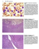 Атлас патологии Роббинса и Котрана