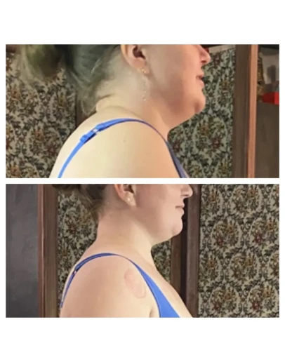 Видео урок массаж дренаж для уменьшения объёмов тела Видео урок массаж дренаж для уменьшения объёмов тела