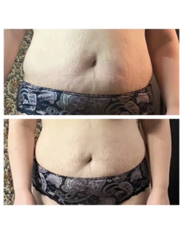 Видео урок - массажа живота для уменьшения объёмов