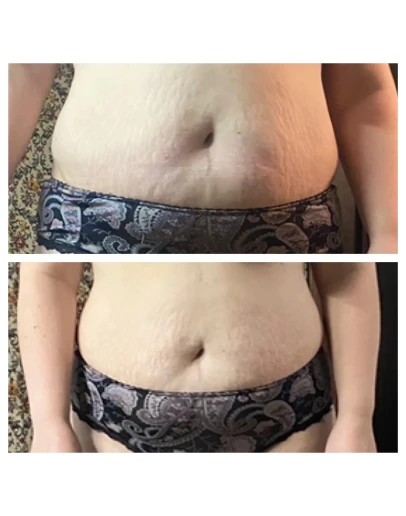 Видео урок - массажа живота для уменьшения объёмов