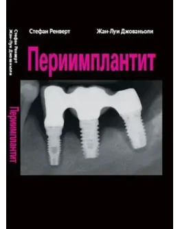 Периимплантит - Ренверт С., Джованьоли Ж-Л.