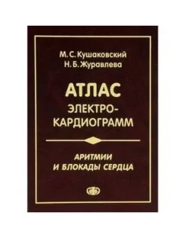 Аритмии и блокады сердца. Атлас электрокардиограмм.