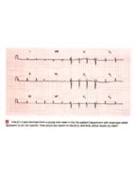 100 проблем ЭКГ
