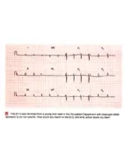 100 проблем ЭКГ
