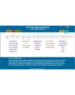 Симулятор ЭКГ-Сердца