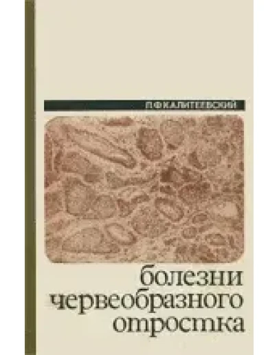 Болезни червеобразного отростка&nbsp&nbspП. В. Калитеевский 197
