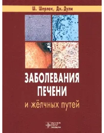Заболевания печени и желчных путей Шерлок Ш.
