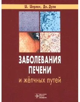 Заболевания печени и желчных путей Шерлок Ш.