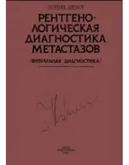 Рентгенологическая диагностика метастазов