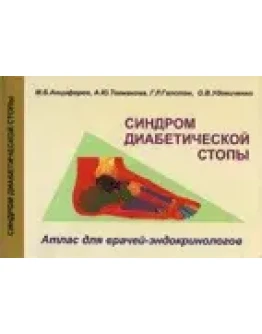 Синдром диабетической стопы, Анциферов М.Б. 2002 г.
