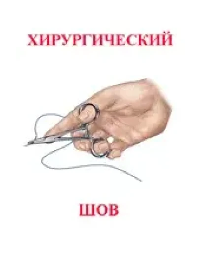 Хирургический шов, Семенов Г.М. 2001 г.