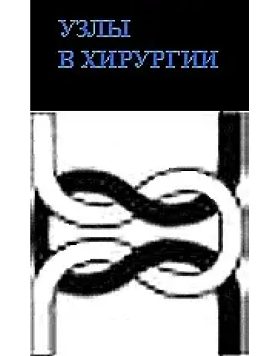 Узлы в хирургии , Слепцов И.В. 2000 г. Узлы в хирургии , Слепцов И.В. 2000 г.