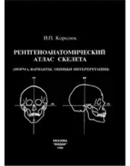 Рентгеноанатомический атлас скелета (норма, варианты, о