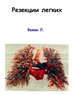 Актуальные вопросы резекции легких , Бежан Л. 1978 г.