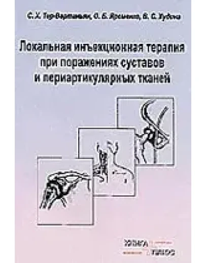 Локальная инъекционная терапия при поражениях суставов