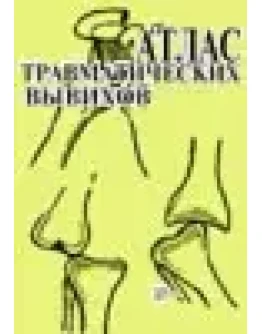 Атлас травматических вывихов, Синило М.И. 1979 г.