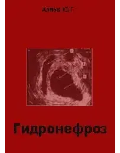 Гидронефроз, Аляев Ю.Г., 2000 г.